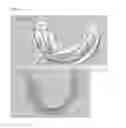 Fig. 04 - Method of manufacturing guide stent of dental implant
