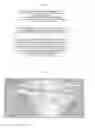 Fig. 07 - Dental implant insertion set and manufacturing method thereof