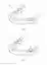 Fig. 02 - Positioning and installing surgical drilling devices and related devices and systems