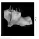 Fig. 07 - 3D dentofacial system and method