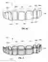 Fig. 06 - Segmented orthodontic appliance with elastics