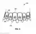 Fig. 07 - Segmented orthodontic appliance with elastics