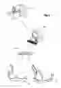 Fig. 07 - Orthognathic implant and methods of use