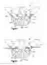 Fig. 09 - Orthognathic implant and methods of use