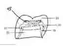 Fig. 01 - COMPANION ENGINEERING AND MANUFACTURING PROCESSES (CEMP) TO OPTIMIZE MULTI-LAYERED ZIRCONIA CROWNS