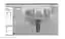 Fig. 01 - Tools for customized design of dental restorations