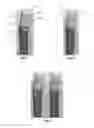 Fig. 02 - Tools for customized design of dental restorations