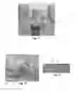 Fig. 06 - Tools for customized design of dental restorations