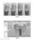 Fig. 07 - Tools for customized design of dental restorations