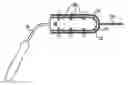 Fig. 01 - Tools and methods for treatment of pelvic conditions