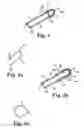 Fig. 02 - Tools and methods for treatment of pelvic conditions