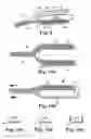 Fig. 07 - Tools and methods for treatment of pelvic conditions