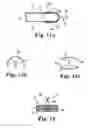 Fig. 08 - Tools and methods for treatment of pelvic conditions