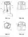 Fig. 02 - DEVICES AND METHODS FOR TREATMENT OF ABDOMINAL AORTIC ANEURYSMS