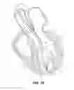 Fig. 09 - DEVICES AND METHODS FOR DELIVERING AN ENDOCARDIAL DEVICE