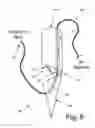 Fig. 09 - RIM ANCHORING SYSTEMS FOR FLEXIBLE SURGICAL IMPLANTS FOR REPLACING CARTILAGE