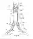 Fig. 06 - ENDOVASCULAR DELIVERY SYSTEM WITH FLEXIBLE AND TORQUEABLE HYPOTUBE