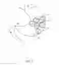 Fig. 07 - Magnetic device to control obesity and related method of use