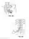 Fig. 08 - SYSTEM AND METHOD FOR THERAPEUTIC MANAGEMENT OF UNPRODUCTIVE COUGH