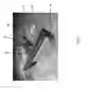 Fig. 08 - Tattoo arm rest