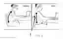 Fig. 07 - Neck pain and headache relief device