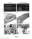 Fig. 07 - Methods for the treatment of tinnitus induced by cochlear excitotoxicity