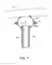 Fig. 07 - Devices, methods and systems for counterpulsation and blood flow conduit connection