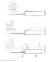 Fig. 35 - Fluid transfer devices