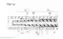 Fig. 16 - Catheter assembly