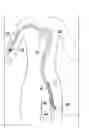 Fig. 01 - Vascular delivery devices