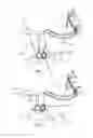 Fig. 02 - System for use in horseback riding