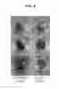 Fig. 09 - Antifreeze member