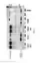 Fig. 09 - Multiprotein expression cassettes