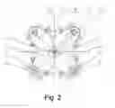 Fig. 03 - METHOD OF CONTINUOUSLY RAISING AND LOWERING OILFIELD SAFT DRILLSTRING AND TWIN TRAVELLING SLIPS APPARATUS