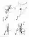 Fig. 17 - Limited entry phased perforating gun system and method