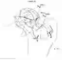 Fig. 13 - Method for determining bone resection on a deformed bone surface from few parameters