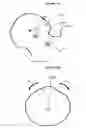 Fig. 14 - Method for determining bone resection on a deformed bone surface from few parameters