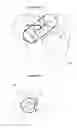 Fig. 16 - Method for determining bone resection on a deformed bone surface from few parameters