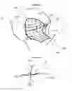 Fig. 18 - Method for determining bone resection on a deformed bone surface from few parameters