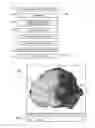 Fig. 02 - System and method for modeling a biopsy specimen