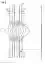 Fig. 08 - High voltage electrostatic generator