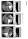 Fig. 30 - Imaging systems and methods for immersive surveillance
