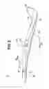Fig. 04 - Lawn mower cutter blade