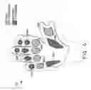 Fig. 04 - Energy absorbing athletic glove