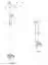 Fig. 09 - Walking aid including bendable puck coupled between a foot and handle