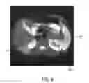 Fig. 09 - Estimation of incoherent motion parameters from diffusion-weighted MRI data