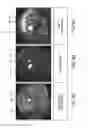 Fig. 10 - Estimation of incoherent motion parameters from diffusion-weighted MRI data