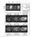 Fig. 11 - Estimation of incoherent motion parameters from diffusion-weighted MRI data