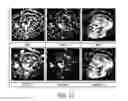 Fig. 13 - Estimation of incoherent motion parameters from diffusion-weighted MRI data