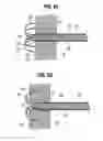 Fig. 07 - Apical puncture access and closure system